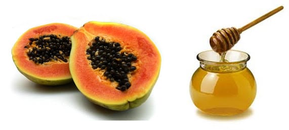 Home Remedies to Prevent Acne