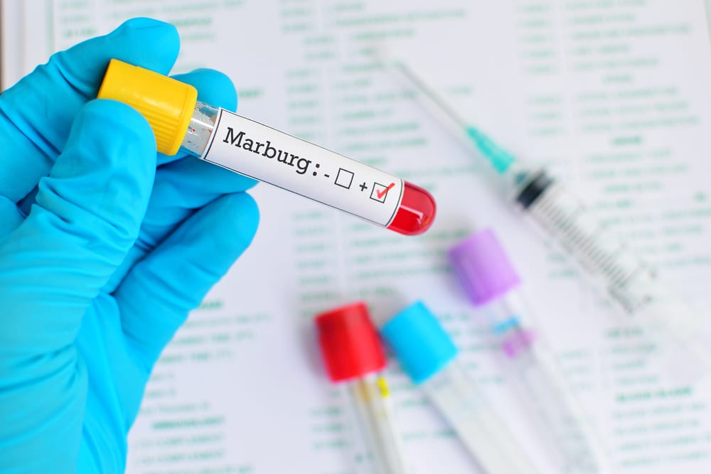 Most Dangerous Viruses - Marburg Virus