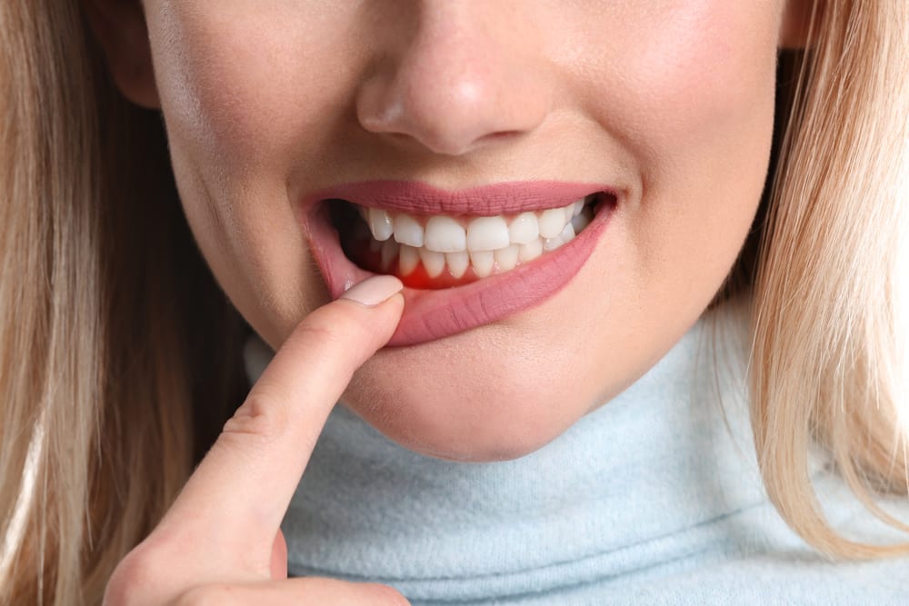 Benefits of Professional Dental Cleanings - Treat Gum Disease